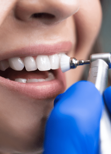 Cleaning and Polishing